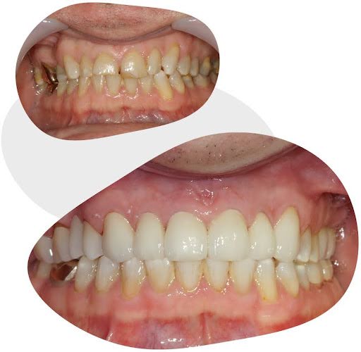cosmetic dentistry before and after