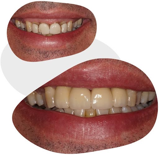 cosmetic dentistry results