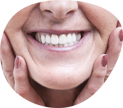 smiling older woman showing healthy white teeth after visiting a dentist in Fitzroy