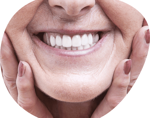 Woman wearing her new dental implants