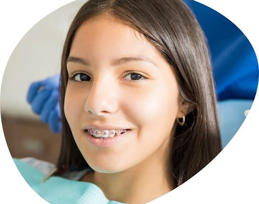 Girl wearing metal braces with orthodontically shaped face