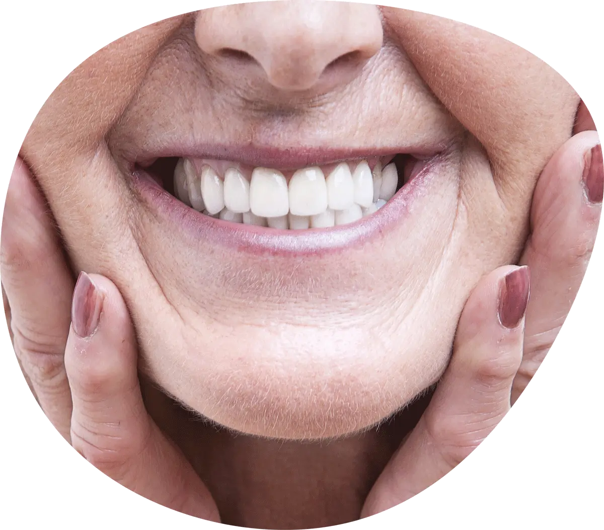 dental implants in prospect