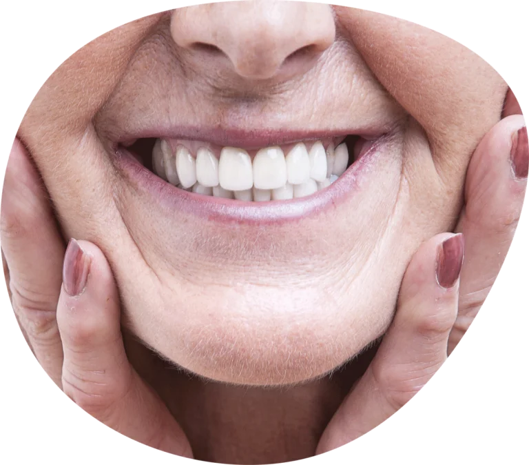 dental implants near thorngate