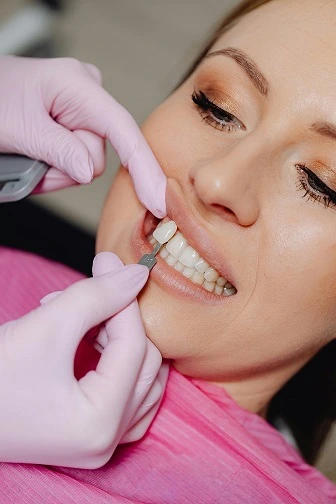 dental veneers adelaide