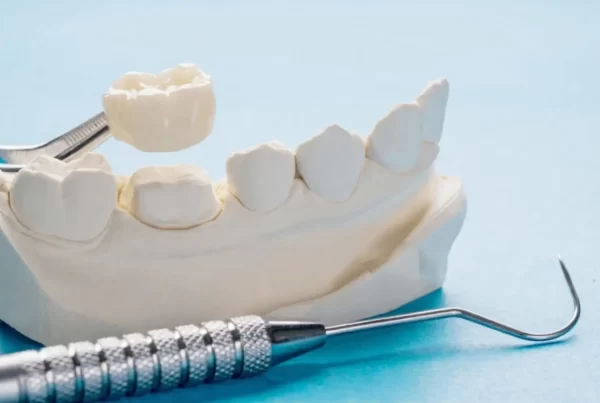 one of common types of dental crown