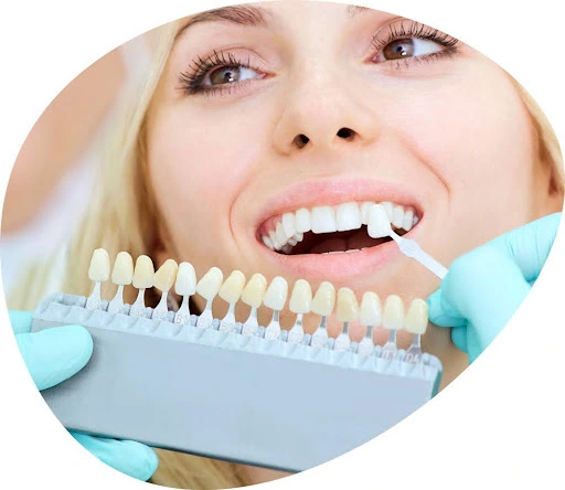 tooth coloured restorations