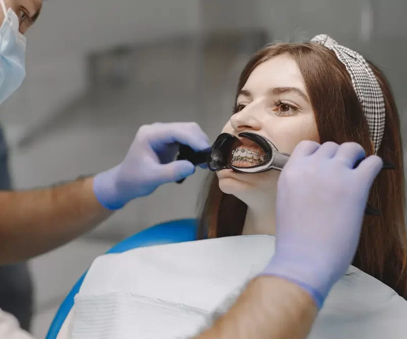 what are ceramic braces