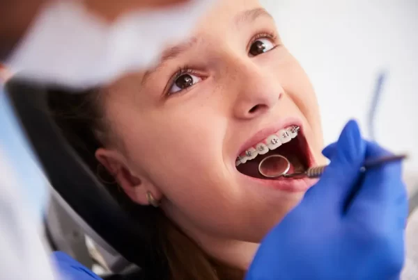 wondering what are ceramic braces