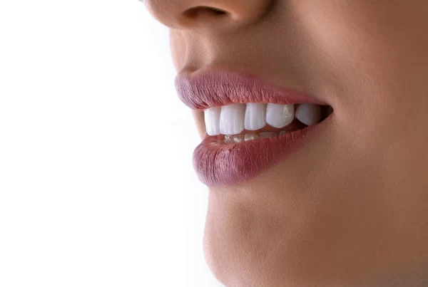 dental bridge vs implant in australia