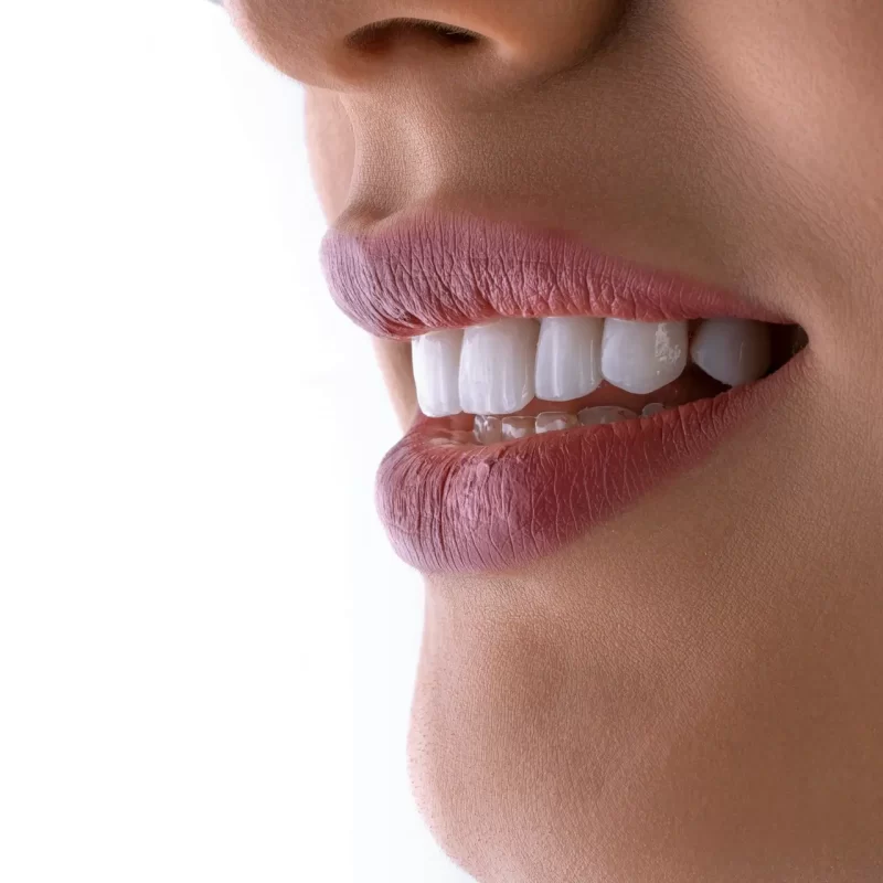 dental bridge vs implant in australia